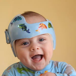 Cranial Remolding Helmet Plagiocephaly Baby